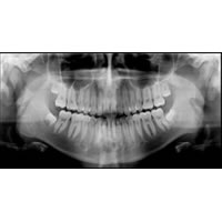 歯科医院 デジタルレントゲン